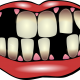 Aparate ortodontice